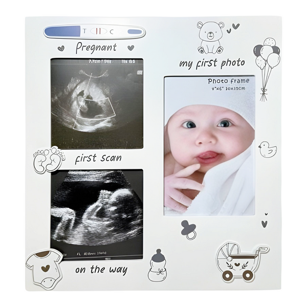 White Wooden Baby's First Ultrasound Sonogram Scan & First Photo  Multi Collage Frame