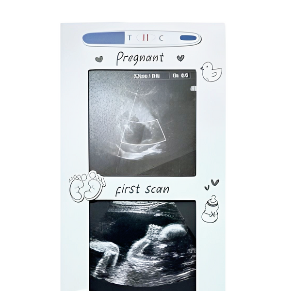 White Wooden Baby's First Ultrasound Sonogram Scan & First Photo Multi Collage Frame