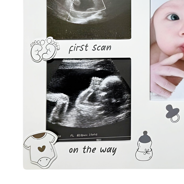 White Wooden Baby's First Ultrasound Sonogram Scan & First Photo  Multi Collage Frame