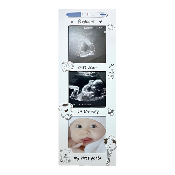 White Wooden Baby's First Ultrasound Sonogram Scan & First Photo Multi Collage Frame